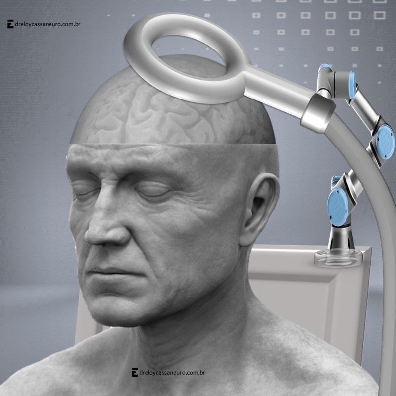 Neuromodulação